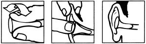 P_Bilsom303_einsetzen.gif (4917 Byte)